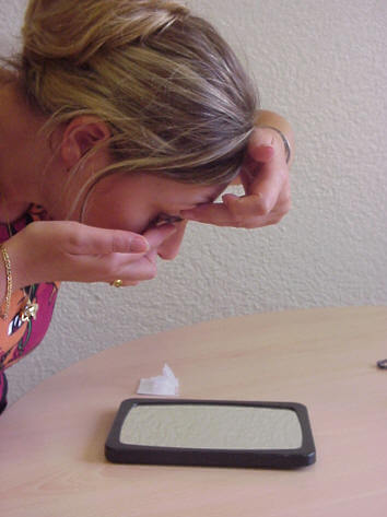 orthokeratologie_manipulation_pose orthokeratologie manipulation pose